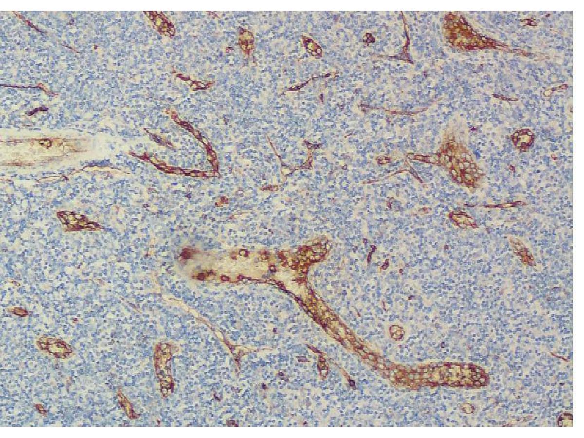 Immunohistochemical analysis of paraffin-embedded human tonsil tissue using anti-CD34 antibody. The section was pre-treated using heat mediated antigen retrieval with Tris-EDTA buffer (pH 9.0) for 20 minutes.The tissues were blocked in 1% BSA for 30 minutes at room temperature, washed with ddH2O and PBS, and then probed with the primary antibody (0108-2, 1/200) for 30 minutes at room temperature. The detection was performed using an HRP conjugated compact polymer system. DAB was used as the chromogen. Tissues were counterstained with hematoxylin and mounted with DPX.