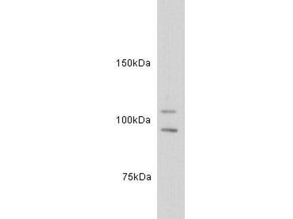 Western blot analysis on jurkat cell lysates using anti-c-kit polyclonal antibody