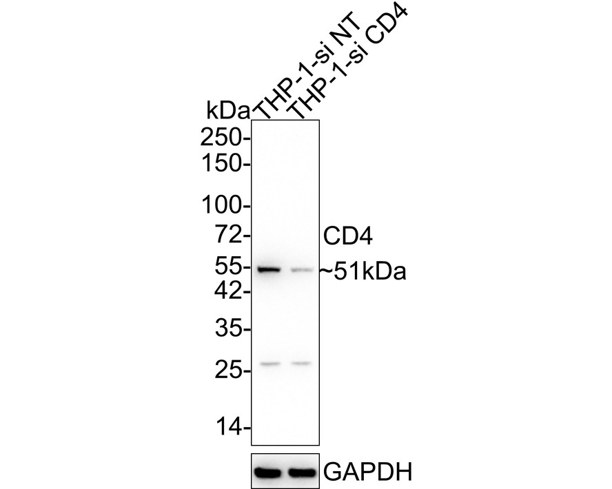 Western blot analysis of CD4 on mouse brain lysate using anti-CD4 antibody at 1/500 dilution.