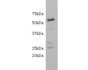 Western blot analysis of CD4 on mouse brain lysate using anti-CD4 antibody at 1/500 dilution.