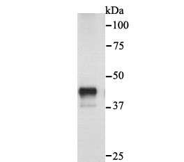 Western blot analysis of Cytokeratin 18 on mouse liver tissue lysate. Proteins were transferred to a PVDF membrane and blocked with 5% BSA in PBS for 1 hour at room temperature. The primary antibody was used at a 1:500 dilution in 5% BSA at room temperature for 2 hours. Goat Anti-Rabbit IgG - HRP Secondary Antibody (HA1001) at 1:5,000 dilution was used for 1 hour at room temperature.