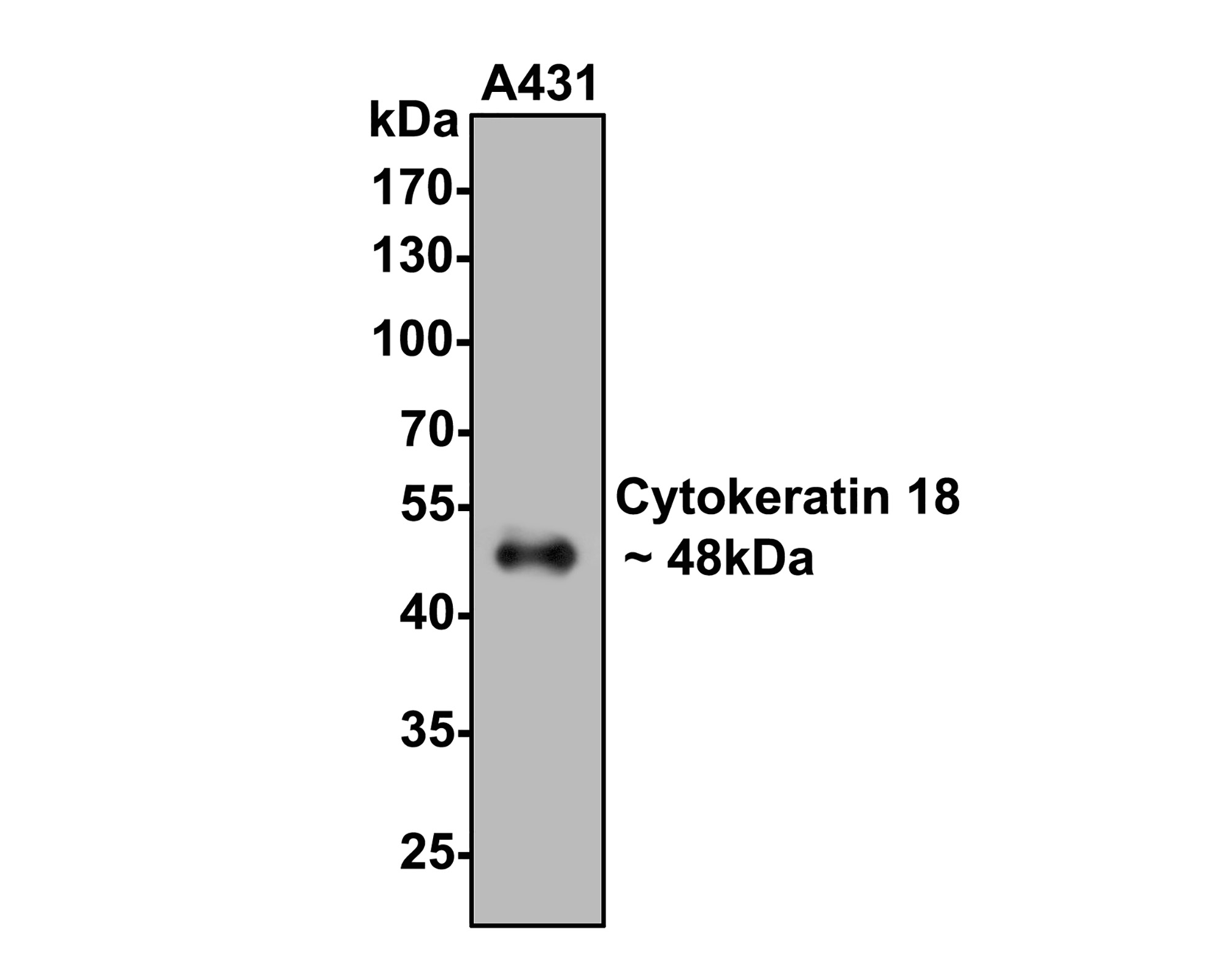 Western blot analysis of Cytokeratin 18 on A431 cell lysates with Rabbit anti-Cytokeratin 18 antibody (0407-1) at 1/500 dilution.<br />
<br />
Lysates/proteins at 10 µg/Lane.<br />
<br />
Predicted band size: 48 kDa<br />
Observed band size: 48 kDa<br />
<br />
Exposure time: 30 seconds;<br />
<br />
10% SDS-PAGE gel.<br />
<br />
Proteins were transferred to a PVDF membrane and blocked with 5% NFDM/TBST for 1 hour at room temperature. The primary antibody (0407-1) at 1/500 dilution was used in 5% NFDM/TBST at room temperature for 2 hours. Goat Anti-Rabbit IgG - HRP Secondary Antibody (HA1001) at 1:40,000 dilution was used for 1 hour at room temperature.