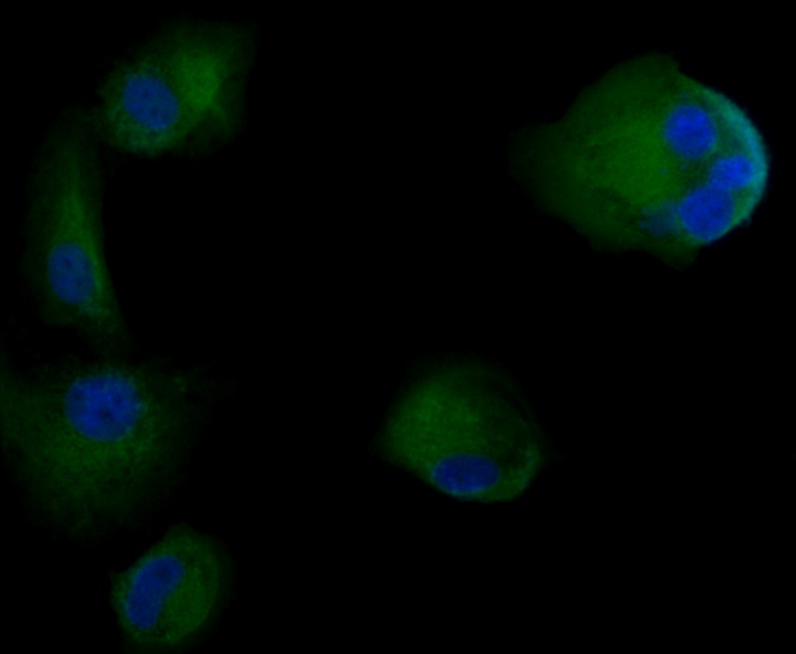 ICC staining Cytokeratin 18 in SW480 cells (green). Formalin fixed cells were permeabilized with 0.1% Triton X-100 in TBS for 10 minutes at room temperature and blocked with 1% Blocker BSA for 15 minutes at room temperature. Cells were probed with the antibody (0407-1) at a dilution of 1:100 for 1 hour at room temperature, washed with PBS. Alexa Fluorc™ 488 Goat anti-Rabbit IgG was used as the secondary antibody at 1/100 dilution. The nuclear counter stain is DAPI (blue).