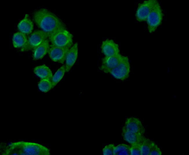 ICC staining Cytokeratin 18 in SW480 cells (green). Formalin fixed cells were permeabilized with 0.1% Triton X-100 in TBS for 10 minutes at room temperature and blocked with 1% Blocker BSA for 15 minutes at room temperature. Cells were probed with the antibody (0407-1) at a dilution of 1/100 for 1 hour at room temperature, washed with PBS. Alexa Fluor™ 488 Goat anti-Rabbit IgG was used as the secondary antibody at 1/100 dilution. The nuclear counter stain is DAPI (blue).