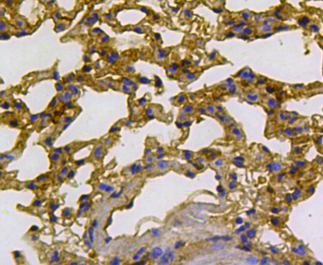 Immunohistochemical analysis of paraffin-embedded mouse kidney tissue using anti-Cytokeratin 18 antibody. The section was pre-treated using heat mediated antigen retrieval with Tris-EDTA buffer (pH 8.0-8.4) for 20 minutes.The tissues were blocked in 5% BSA for 30 minutes at room temperature, washed with ddH2O and PBS, and then probed with the antibody (0407-1) at 1/100 dilution, for 30 minutes at room temperature and detected using an HRP conjugated compact polymer system. DAB was used as the chrogen. Counter stained with hematoxylin and mounted with DPX.