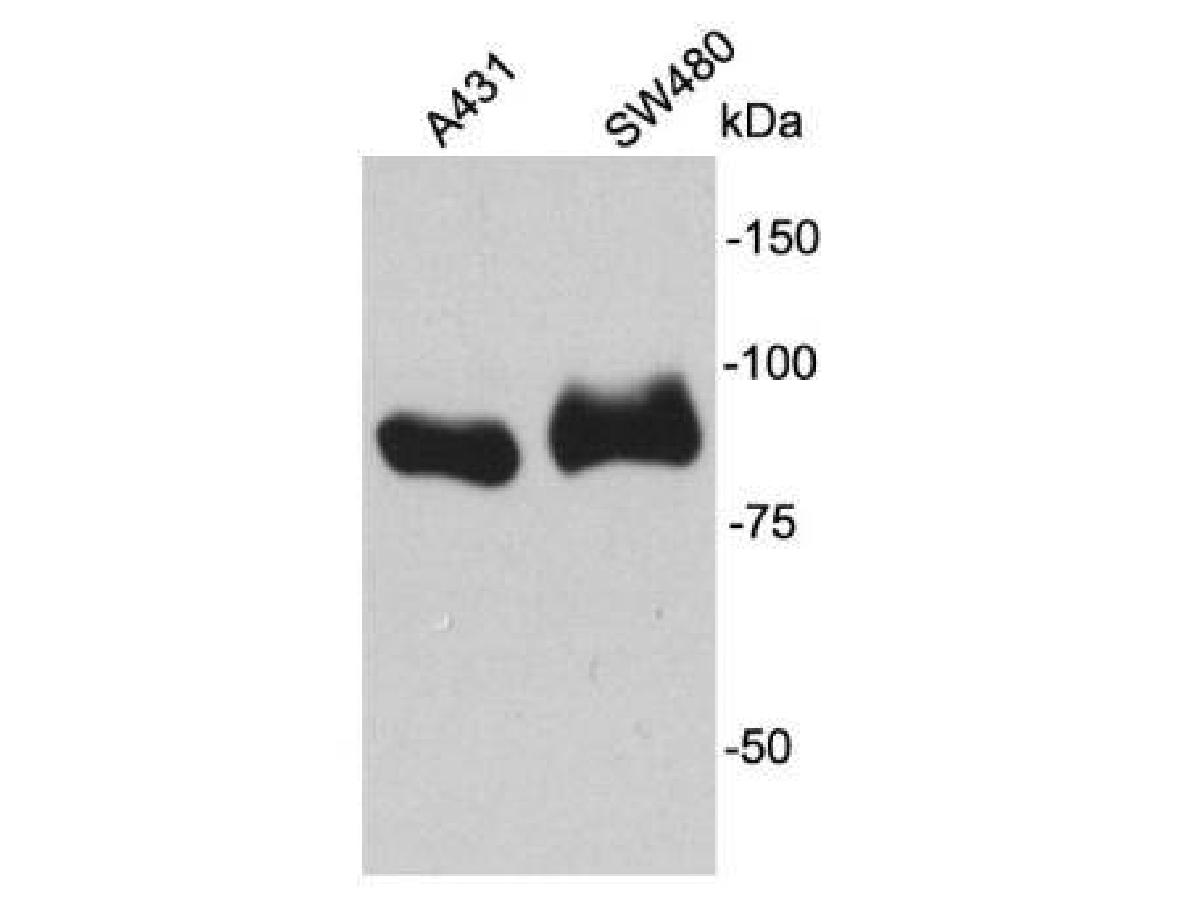 Western blot analysis of beta Catenin on different lysates. Proteins were transferred to a PVDF membrane and blocked with 5% NFDM/TBST for 1 hour at room temperature. The primary antibody (0407-16, 1/5,000) was used in 5% NFDM/TBST at room temperature for 1 hour. Goat Anti-Rabbit IgG - HRP Secondary Antibody (HA1001) at 1:200,000 dilution was used for 45 mins at room temperature.