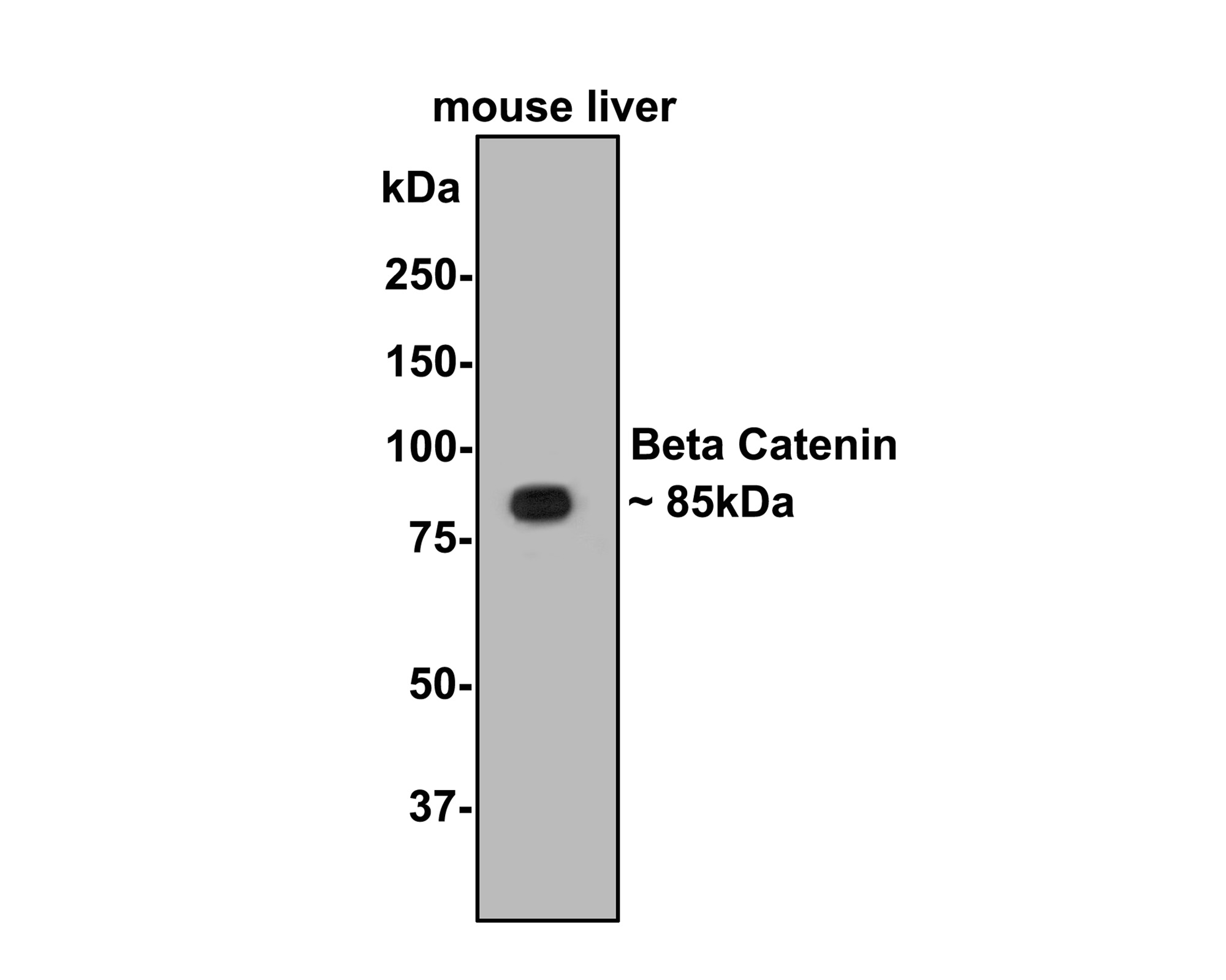 Western blot analysis of Beta Catenin on mouse liver tissue lysates with Rabbit anti-Beta Catenin antibody (0407-16) at 1/500 dilution.<br />
<br />
Lysates/proteins at 10 µg/Lane.<br />
<br />
Predicted band size: 85 kDa<br />
Observed band size: 85 kDa<br />
<br />
Exposure time: 30 seconds;<br />
<br />
8% SDS-PAGE gel.<br />
<br />
Proteins were transferred to a PVDF membrane and blocked with 5% NFDM/TBST for 1 hour at room temperature. The primary antibody (0407-16) at 1/500 dilution was used in 5% NFDM/TBST at room temperature for 2 hours. Goat Anti-Rabbit IgG - HRP Secondary Antibody (HA1001) at 1:40,000 dilution was used for 1 hour at room temperature.