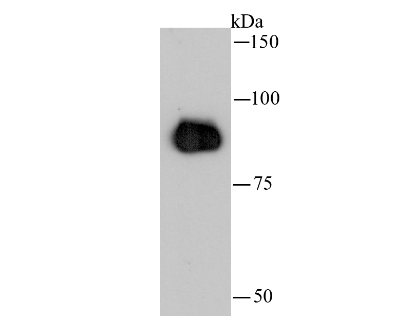ICC staining of beta Catenin in SW480 cells (green). Formalin fixed cells were permeabilized with 0.1% Triton X-100 in TBS for 10 minutes at room temperature and blocked with 1% Blocker BSA for 15 minutes at room temperature. Cells were probed with the primary antibody (0407-16, 1/50) for 1 hour at room temperature, washed with PBS. Alexa Fluor®488 Goat anti-Rabbit IgG was used as the secondary antibody at 1/1,000 dilution.