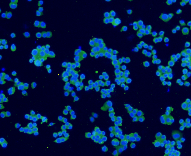 ICC staining Synaptophysin in N2A cells (green). The nuclear counter stain is DAPI (blue). Cells were fixed in paraformaldehyde, permeabilised with 0.25% Triton X100/PBS.
