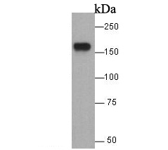 Western blot analysis of EGFR on A431 cell lysate. Proteins were transferred to a PVDF membrane and blocked with 5% BSA in PBS for 1 hour at room temperature. The primary antibody was used at a 1:500 dilution in 5% BSA at room temperature for 2 hours. Goat Anti-Rabbit IgG - HRP Secondary Antibody (HA1001) at 1:5,000 dilution was used for 1 hour at room temperature.