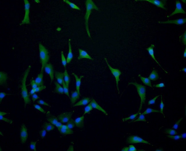 ICC staining EGFR in A172 cells (green). Formalin fixed cells were permeabilized with 0.1% Triton X-100 in TBS for 10 minutes at room temperature and blocked with 1% Blocker BSA for 15 minutes at room temperature. Cells were probed with the antibody (0407-21) at a dilution of 1:100 for 1 hour at room temperature, washed with PBS. Alexa Fluorc™ 488 Goat anti-Rabbit IgG was used as the secondary antibody at 1/100 dilution. The nuclear counter stain is DAPI (blue).