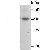 Western blot analysis of E Cadherin on A431 cell lysate. Proteins were transferred to a PVDF membrane and blocked with 5% BSA in PBS for 1 hour at room temperature. The primary antibody was used at a 1:500 dilution in 5% BSA at room temperature for 2 hours. Goat Anti-Rabbit IgG - HRP Secondary Antibody (HA1001) at 1:5,000 dilution was used for 1 hour at room temperature.