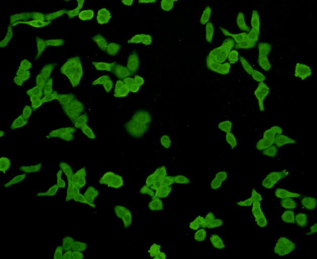 ICC staining E-Cadherin in SKOV-3 cells (green). Formalin fixed cells were permeabilized with 0.1% Triton X-100 in TBS for 10 minutes at room temperature and blocked with 1% Blocker BSA for 15 minutes at room temperature. Cells were probed with the antibody (0407-25) at a dilution of 1:200 for 1 hour at room temperature, washed with PBS. Alexa Fluorc™ 488 Goat anti-Rabbit IgG was used as the secondary antibody at 1/100 dilution.