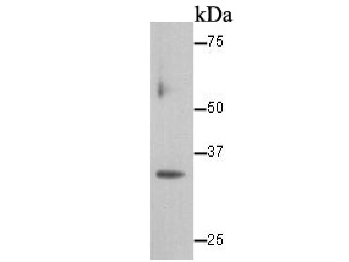 Western blot analysis of Cyclin D1 on MCF-7 lysate. Proteins were transferred to a PVDF membrane and blocked with 5% BSA in PBS for 1 hour at room temperature. The primary antibody was used at a 1:5,000 dilution in 5% BSA at room temperature for 2 hours. Goat Anti-Rabbit IgG - HRP Secondary Antibody (HA1001) at 1:5,000 dilution was used for 1 hour at room temperature.