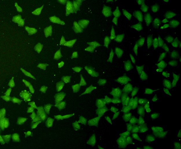 ICC staining Cyclin D1 in A549 cells (green). Formalin fixed cells were permeabilized with 0.1% Triton X-100 in TBS for 10 minutes at room temperature and blocked with 1% Blocker BSA for 15 minutes at room temperature. Cells were probed with the antibody (0407-27) at a dilution of 1:200 for 1 hour at room temperature, washed with PBS. Alexa Fluorc™ 488 Goat anti-Rabbit IgG was used as the secondary antibody at 1/100 dilution.