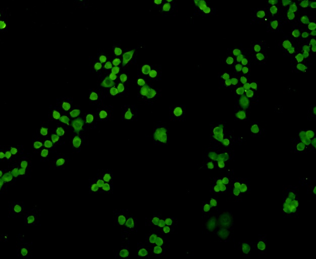 ICC staining Cyclin D1 in N2A cells (green). Formalin fixed cells were permeabilized with 0.1% Triton X-100 in TBS for 10 minutes at room temperature and blocked with 1% Blocker BSA for 15 minutes at room temperature. Cells were probed with the antibody (0407-27) at a dilution of 1:100 for 1 hour at room temperature, washed with PBS. Alexa Fluorc™ 488 Goat anti-Rabbit IgG was used as the secondary antibody at 1/100 dilution.