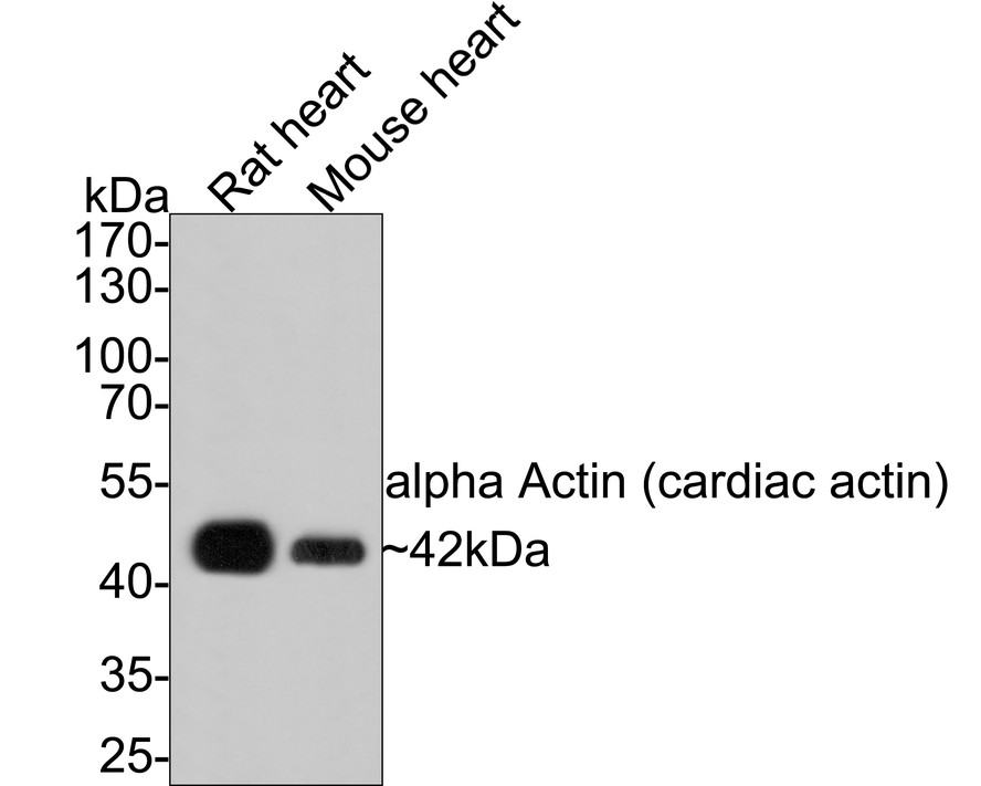 Western blot analysis of alpha Actin (cardiac actin) on different lysates with Rabbit anti-alpha Actin (cardiac actin) antibody (0407-3) at 1/500 dilution.<br />
<br />
Lane 1: Rat heart tissue lysate<br />
Lane 2: Mouse heart tissue lysate<br />
<br />
Lysates/proteins at 20 µg/Lane.<br />
<br />
Predicted band size: 42 kDa<br />
Observed band size: 42 kDa<br />
<br />
Exposure time: 2 minutes;<br />
<br />
10% SDS-PAGE gel.<br />
<br />
Proteins were transferred to a PVDF membrane and blocked with 5% NFDM/TBST for 1 hour at room temperature. The primary antibody (0407-3) at 1/500 dilution was used in 5% NFDM/TBST at room temperature for 2 hours. Goat Anti-Rabbit IgG - HRP Secondary Antibody (HA1001) at 1:300,000 dilution was used for 1 hour at room temperature.