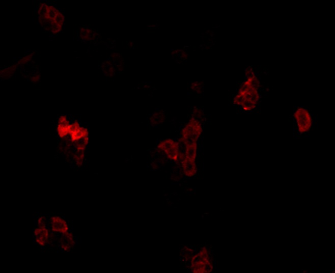 ICC staining Cytokeratin 17 in A431 cells (red). Formalin fixed cells were permeabilized with 0.1% Triton X-100 in TBS for 10 minutes at room temperature and blocked with 1% Blocker BSA for 15 minutes at room temperature. Cells were probed with the antibody (0407-4) at a dilution of 1:100 for 1 hour at room temperature, washed with PBS. Alexa Fluor™594 Goat anti-Rabbit IgG was used as the secondary antibody at 1/100 dilution.