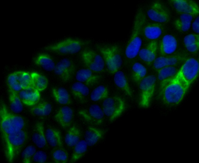 ICC staining Cytokeratin 17 in Hela cells (green). Formalin fixed cells were permeabilized with 0.1% Triton X-100 in TBS for 10 minutes at room temperature and blocked with 1% Blocker BSA for 15 minutes at room temperature. Cells were probed with the antibody (0407-4) at a dilution of 1:100 for 1 hour at room temperature, washed with PBS. Alexa Fluorc™ 488 Goat anti-Rabbit IgG was used as the secondary antibody at 1/100 dilution. The nuclear counter stain is DAPI (blue).