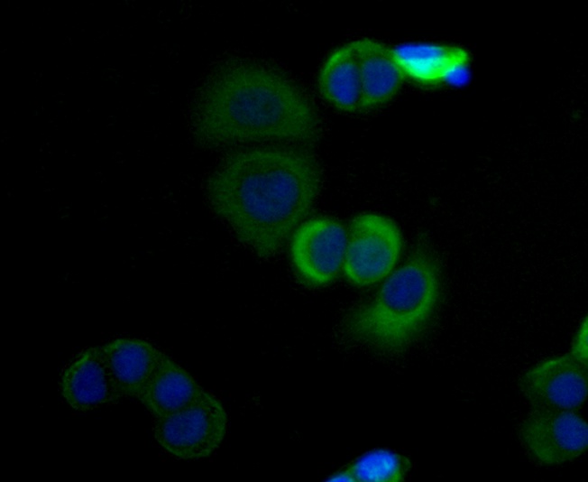 ICC staining Cytokeratin 17 in SK-Br-3 cells (green). Formalin fixed cells were permeabilized with 0.1% Triton X-100 in TBS for 10 minutes at room temperature and blocked with 1% Blocker BSA for 15 minutes at room temperature. Cells were probed with the antibody (0407-4) at a dilution of 1:100 for 1 hour at room temperature, washed with PBS. Alexa Fluor™ 488 Goat anti-Rabbit IgG was used as the secondary antibody at 1/100 dilution. The nuclear counter stain is DAPI (blue).