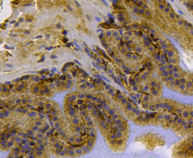 Immunohistochemical analysis of paraffin-embedded mouse prostate tissue using anti-Cytokeratin 17 antibody. The section was pre-treated using heat mediated antigen retrieval with Tris-EDTA buffer (pH 8.0-8.4) for 20 minutes.The tissues were blocked in 5% BSA for 30 minutes at room temperature, washed with ddH2O and PBS, and then probed with the antibody (0407-4) at 1/100 dilution, for 30 minutes at room temperature and detected using an HRP conjugated compact polymer system. DAB was used as the chrogen. Counter stained with hematoxylin and mounted with DPX.