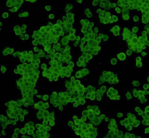 ICC staining 14-3-3 b/a in N2A cells (green). Cells were fixed in paraformaldehyde, permeabilised with 0.25% Triton X100/PBS.