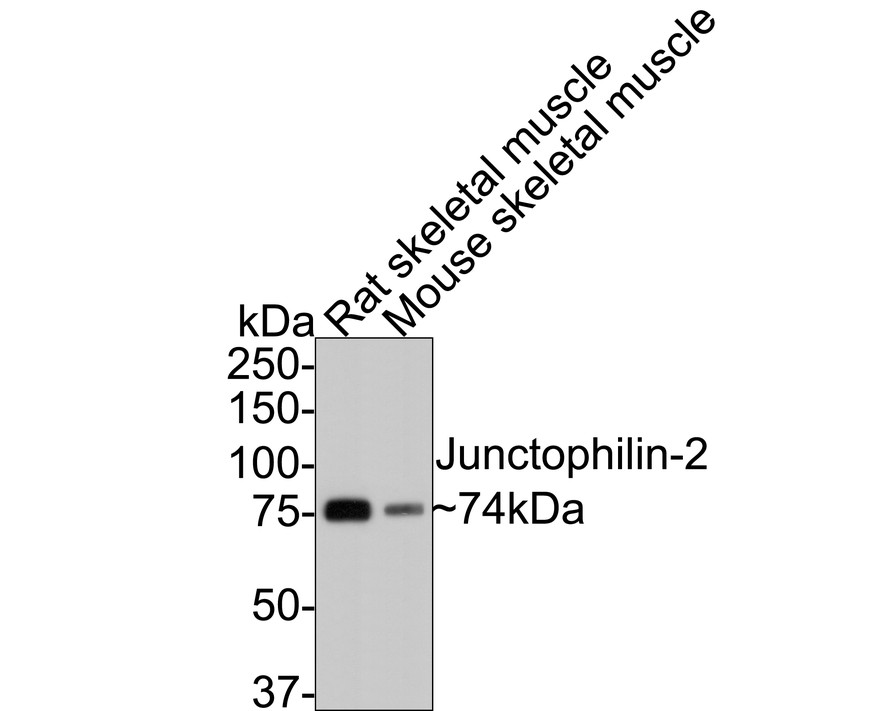 Western blot analysis of Junctophilin-2 on different lysates with Rabbit anti-Junctophilin-2 antibody (0407-9) at 1/2,000 dilution.<br />
<br />
Lane 1: Rat skeletal muscle tissue lysate<br />
Lane 2: Mouse skeletal muscle tissue lysate<br />
<br />
Lysates/proteins at 20 µg/Lane.<br />
<br />
Predicted band size: 74 kDa<br />
Observed band size: 74 kDa<br />
<br />
Exposure time: 2 minutes;<br />
<br />
8% SDS-PAGE gel.<br />
<br />
Proteins were transferred to a PVDF membrane and blocked with 5% NFDM/TBST for 1 hour at room temperature. The primary antibody (0407-9) at 1/2,000 dilution was used in 5% NFDM/TBST at room temperature for 2 hours. Goat Anti-Rabbit IgG - HRP Secondary Antibody (HA1001) at 1:300,000 dilution was used for 1 hour at room temperature.