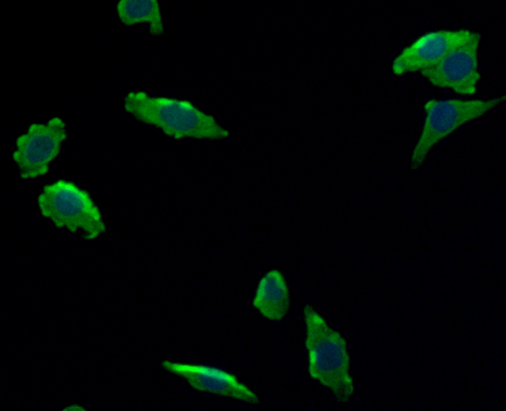 ICC staining Tie-1 in SW620 cells (green). The nuclear counter stain is DAPI (blue). Cells were fixed in paraformaldehyde, permeabilised with 0.25% Triton X100/PBS.