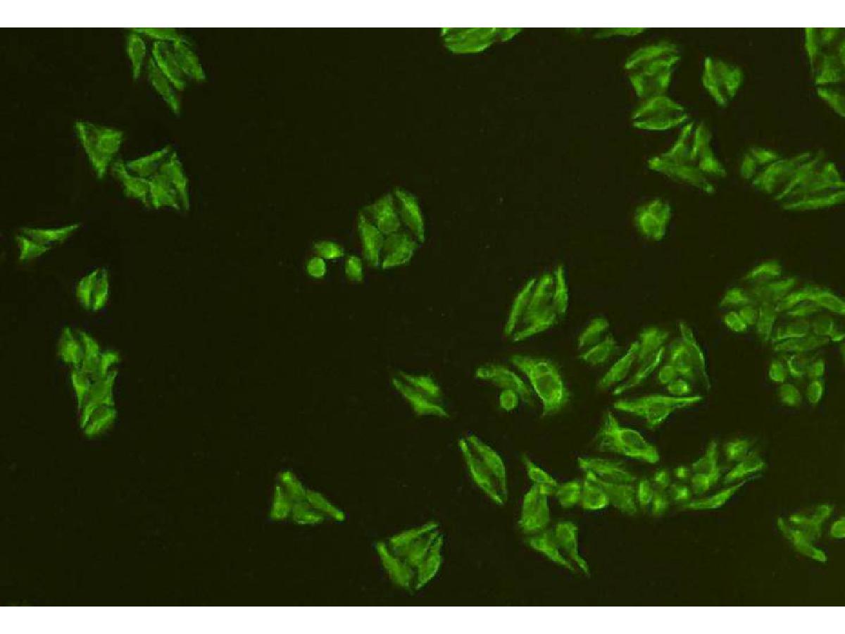 ICC staining of CD24 in Hela cells (green). Formalin fixed cells were permeabilized with 0.1% Triton X-100 in TBS for 10 minutes at room temperature and blocked with 1% Blocker BSA for 15 minutes at room temperature. Cells were probed with the primary antibody (0804-4, 1/50) for 1 hour at room temperature, washed with PBS. Alexa Fluor®488 Goat anti-Rabbit IgG was used as the secondary antibody at 1/1,000 dilution. The nuclear counter stain is DAPI (blue).