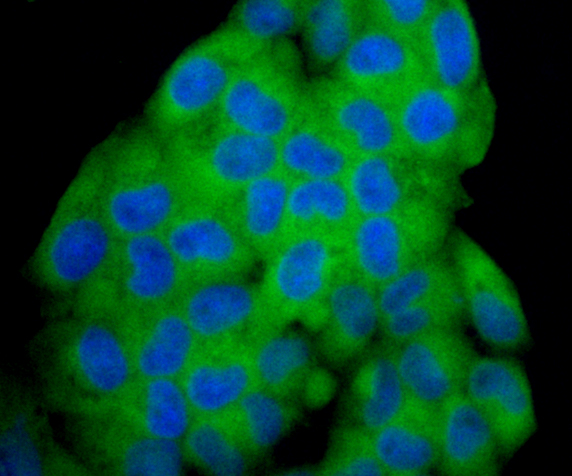ICC staining Noggin in Hela cells (green). The nuclear counter stain is DAPI (blue). Cells were fixed in paraformaldehyde, permeabilised with 0.25% Triton X100/PBS.