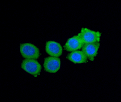 ICC staining Noggin in HepG2 cells (green). The nuclear counter stain is DAPI (blue). Cells were fixed in paraformaldehyde, permeabilised with 0.25% Triton X100/PBS.