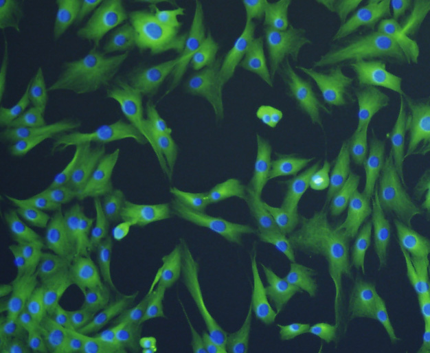 ICC staining Tubulin beta-3 chain in NIH-3T3 cells (green). The nuclear counter stain is DAPI (blue). Cells were fixed in paraformaldehyde, permeabilised with 0.25% Triton X100/PBS.