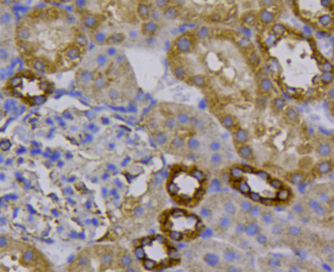 Immunohistochemical analysis of paraffin-embedded rat kidney tissue using anti-Tubulin beta-3 chain antibody. Counter stained with hematoxylin.