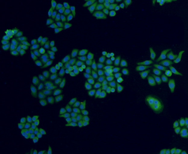 ICC staining CD10 in HepG2 cells (green). The nuclear counter stain is DAPI (blue). Cells were fixed in paraformaldehyde, permeabilised with 0.25% Triton X100/PBS.