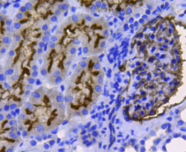 Immunohistochemical analysis of paraffin-embedded human kidney tissue using anti-CD10 antibody. Counter stained with hematoxylin.
