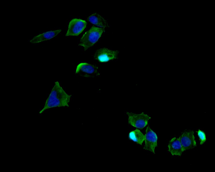 ICC staining NCAML1 in Hela cells (green). The nuclear counter stain is DAPI (blue). Cells were fixed in paraformaldehyde, permeabilised with 0.25% Triton X100/PBS.