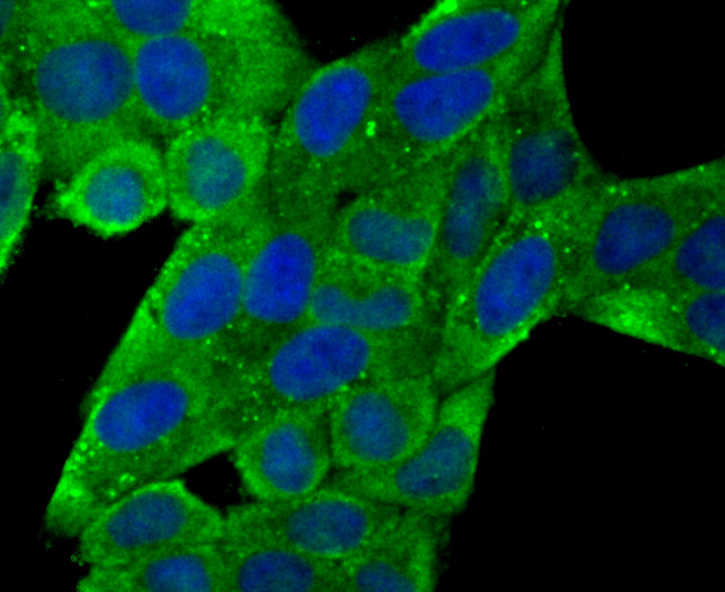 ICC staining NCAML1 in 293T cells (green). The nuclear counter stain is DAPI (blue). Cells were fixed in paraformaldehyde, permeabilised with 0.25% Triton X100/PBS.