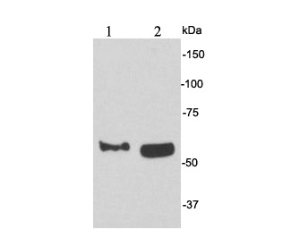 Western blot analysis of CD62E on different cell lysates using anti-CD62E antibody at 1/500 dilution.<br />
Positive control:<br />
Lane 1: MCF-7<br />
Lane 2: Raji
