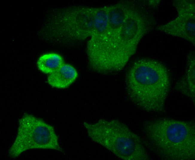 ICC staining CD3 zeta in A549 cells (green). The nuclear counter stain is DAPI (blue). Cells were fixed in paraformaldehyde, permeabilised with 0.25% Triton X100/PBS.