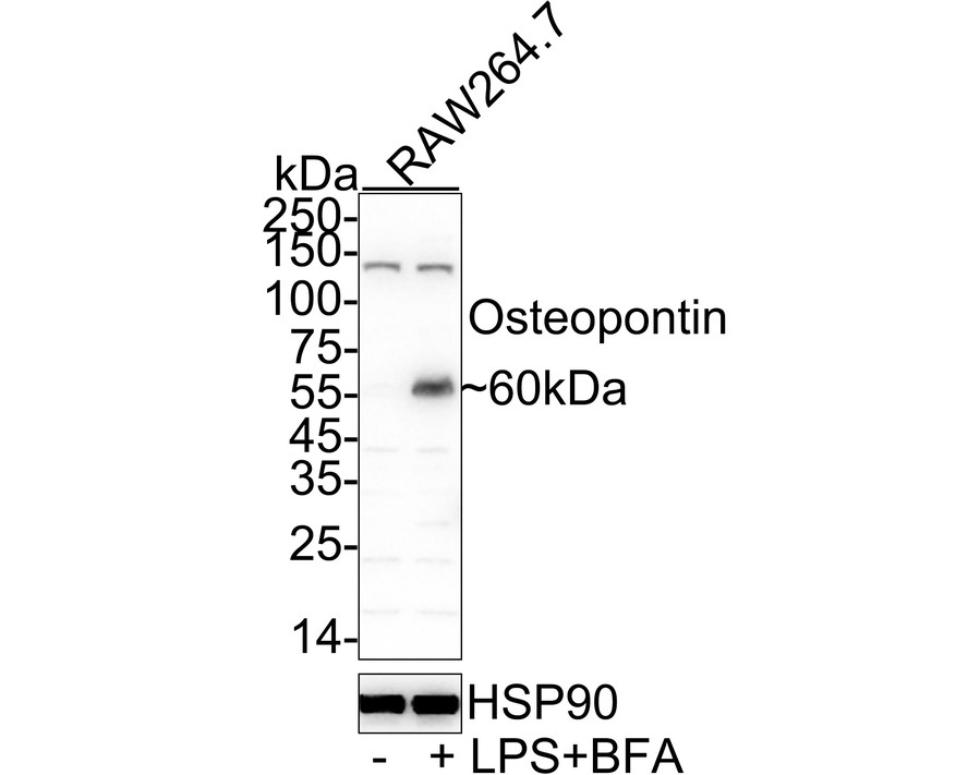 Western blot analysis of Osteopontin on rat bone marrow tissue lysates with Rabbit anti-Osteopontin antibody (0806-6) at 1/500 dilution.<br />
<br />
Lysates/proteins at 20 µg/Lane.<br />
<br />
Predicted band size: 35 kDa<br />
Observed band size: 35 kDa<br />
<br />
Exposure time: 2 minutes;<br />
<br />
12% SDS-PAGE gel.<br />
<br />
Proteins were transferred to a PVDF membrane and blocked with 5% NFDM/TBST for 1 hour at room temperature. The primary antibody (0806-6) at 1/500 dilution was used in 5% NFDM/TBST at room temperature for 2 hours. Goat Anti-Rabbit IgG - HRP Secondary Antibody (HA1001) at 1:300,000 dilution was used for 1 hour at room temperature.
