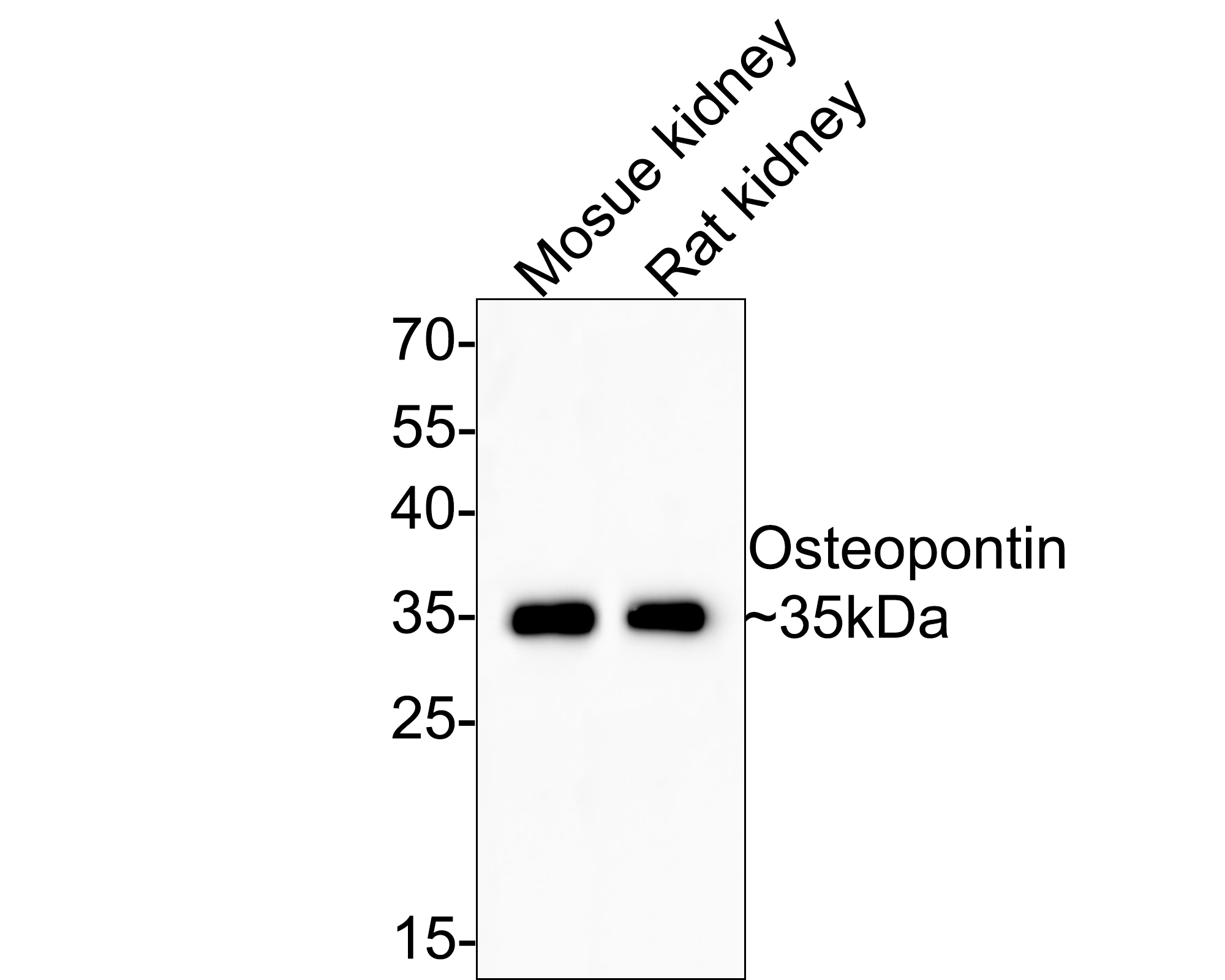 Western blot analysis of Osteopontin on different lysates with Rabbit anti-Osteopontin antibody (0806-6) at 1/2,000 dilution.<br />
<br />
Lane 1: Mouse kidney tissue lysate<br />
Lane 2: Rat kidney tissue lysate<br />
<br />
Lysates/proteins at 20 µg/Lane.<br />
<br />
Predicted band size: 35 kDa<br />
Observed band size: 35 kDa<br />
<br />
Exposure time: 2 minutes;<br />
<br />
12% SDS-PAGE gel.<br />
<br />
Proteins were transferred to a PVDF membrane and blocked with 5% NFDM/TBST for 1 hour at room temperature. The primary antibody (0806-6) at 1/2,000 dilution was used in 5% NFDM/TBST at room temperature for 2 hours. Goat Anti-Rabbit IgG - HRP Secondary Antibody (HA1001) at 1:300,000 dilution was used for 1 hour at room temperature.