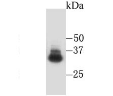 Western blot analysis of Glycophorin A on human liver tissue lysate. Proteins were transferred to a PVDF membrane and blocked with 5% BSA in PBS for 1 hour at room temperature. The primary antibody was used at a 1/500 dilution in 5% BSA at room temperature for 2 hours. Goat Anti-Rabbit IgG - HRP Secondary Antibody (HA1001) at 1:5,000 dilution was used for 1 hour at room temperature.
