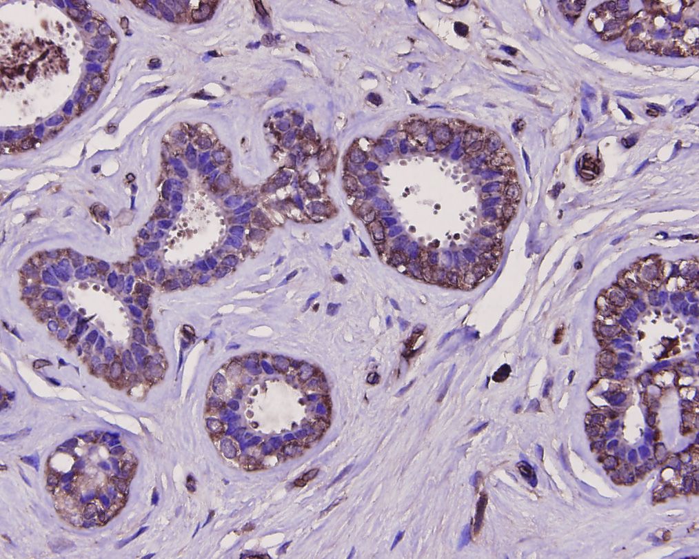 Immunohistochemical analysis of paraffin-embedded human breast tissue using anti-Osteopontin antibody. The section was pre-treated using heat mediated antigen retrieval with sodium citrate buffer (pH 6.0) for 20 minutes. The tissues were blocked in 5% BSA for 30 minutes at room temperature, washed with ddH2O and PBS, and then probed with the primary antibody (0806-8, 1/400) for 30 minutes at room temperature. The detection was performed using an HRP conjugated compact polymer system. DAB was used as the chromogen. Tissues were counterstained with hematoxylin and mounted with DPX.