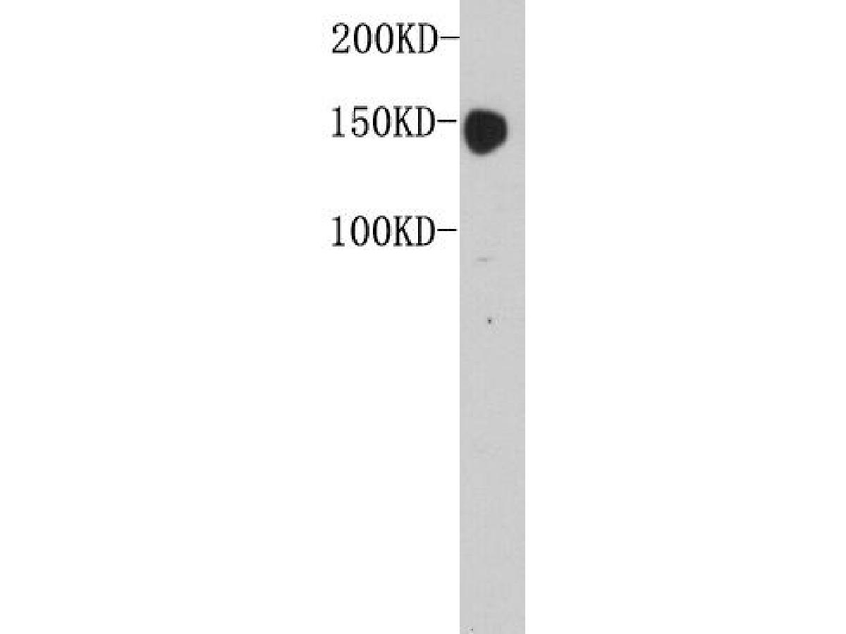 Western blot analysis of Carcino Embryonic Antigen CEA on MCF-7 lysate. Proteins were transferred to a PVDF membrane and blocked with 5% BSA in PBS for 1 hour at room temperature. The primary antibody was used at a 1:500 dilution in 5% BSA at room temperature for 2 hours. Goat Anti-Rabbit IgG - HRP Secondary Antibody (HA1001) at 1:5,000 dilution was used for 1 hour at room temperature.