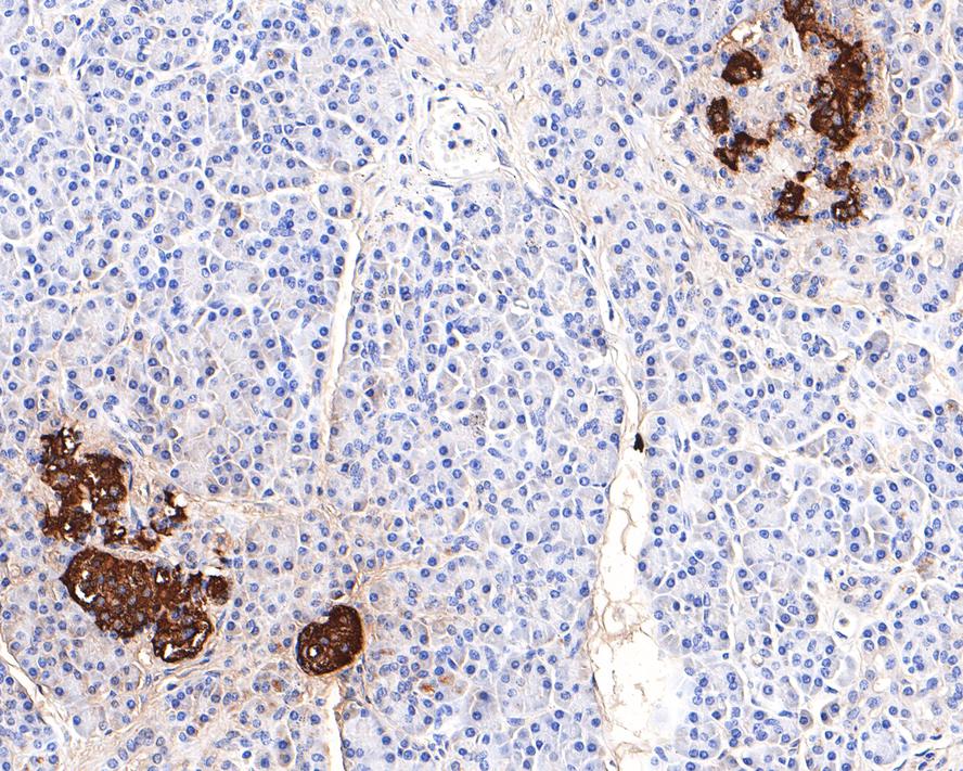 Immunohistochemical analysis of paraffin-embedded human pancreas tissue with Rabbit anti-Insulin B Chain antibody (0807-11) at 1/10,000 dilution.<br />
<br />
The section was pre-treated using heat mediated antigen retrieval with Tris-EDTA buffer (pH 9.0) for 20 minutes. The tissues were blocked in 1% BSA for 20 minutes at room temperature, washed with ddH2O and PBS, and then probed with the primary antibody (0807-11) at 1/10,000 dilution for 1 hour at room temperature. The detection was performed using an HRP conjugated compact polymer system. DAB was used as the chromogen. Tissues were counterstained with hematoxylin and mounted with DPX.