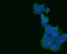 ICC staining of ARF1 in 293 cells (green). Formalin fixed cells were permeabilized with 0.1% Triton X-100 in TBS for 10 minutes at room temperature and blocked with 1% Blocker BSA for 15 minutes at room temperature. Cells were probed with the primary antibody (0807-7, 1/100) for 1 hour at room temperature, washed with PBS. Alexa Fluor®488 Goat anti-Rabbit IgG was used as the secondary antibody at 1/100 dilution. The nuclear counter stain is DAPI (blue).