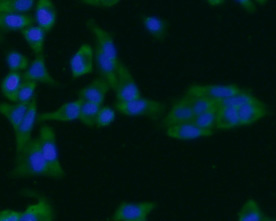 ICC staining of ARF1 in Hela cells (green). Formalin fixed cells were permeabilized with 0.1% Triton X-100 in TBS for 10 minutes at room temperature and blocked with 1% Blocker BSA for 15 minutes at room temperature. Cells were probed with the primary antibody (0807-7, 1/100) for 1 hour at room temperature, washed with PBS. Alexa Fluor®488 Goat anti-Rabbit IgG was used as the secondary antibody at 1/100 dilution. The nuclear counter stain is DAPI (blue).