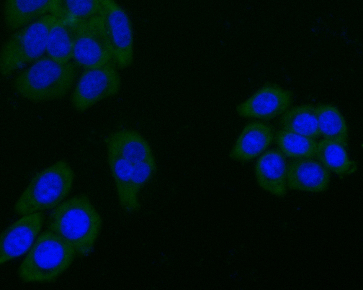ICC staining of ARF1 in HepG2 cells (green). Formalin fixed cells were permeabilized with 0.1% Triton X-100 in TBS for 10 minutes at room temperature and blocked with 1% Blocker BSA for 15 minutes at room temperature. Cells were probed with the primary antibody (0807-7, 1/100) for 1 hour at room temperature, washed with PBS. Alexa Fluor®488 Goat anti-Rabbit IgG was used as the secondary antibody at 1/100 dilution. The nuclear counter stain is DAPI (blue).