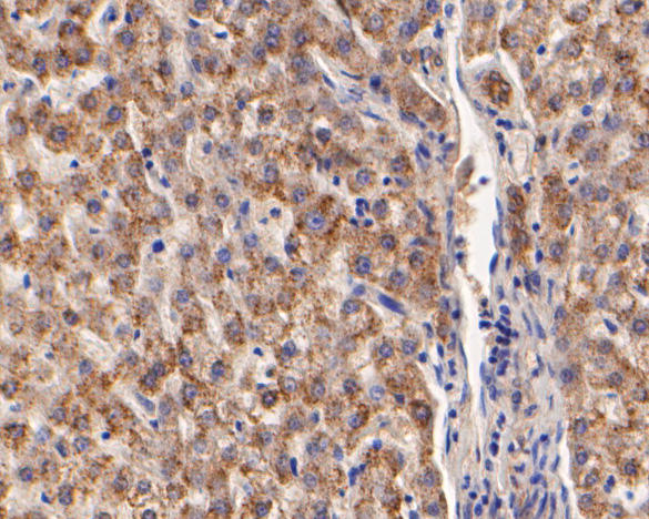 Immunohistochemical analysis of paraffin-embedded human liver tissue using anti-ARF1 antibody. The section was pre-treated using heat mediated antigen retrieval with Tris-EDTA buffer (pH 8.0-8.4) for 20 minutes.The tissues were blocked in 5% BSA for 30 minutes at room temperature, washed with ddH2O and PBS, and then probed with the primary antibody (0807-7, 1/200) for 30 minutes at room temperature. The detection was performed using an HRP conjugated compact polymer system. DAB was used as the chromogen. Tissues were counterstained with hematoxylin and mounted with DPX.