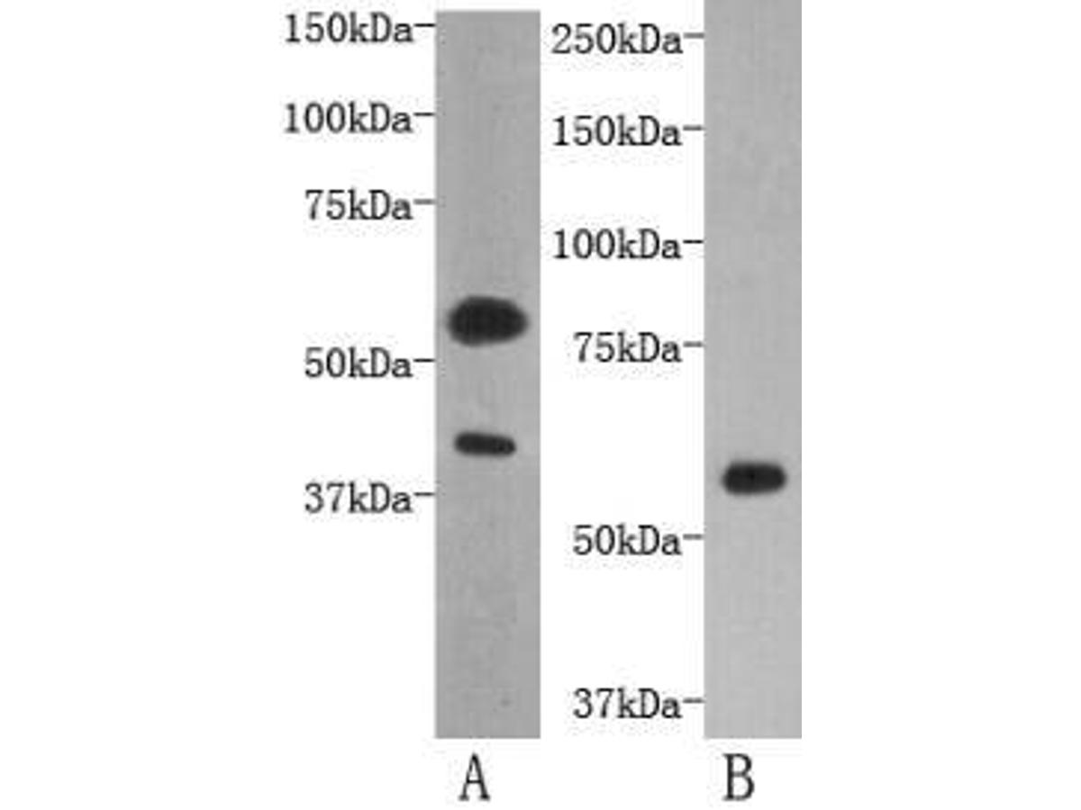 Western blot analysis on human kidney (A) and D3 (B) using anti- TMEM57 polyclonal antibody.